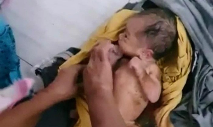 Bayi Perempuan Dibuang di Pinggir Jalan Bekasi, Ari-ari Masih Tersambung Ilustrasi