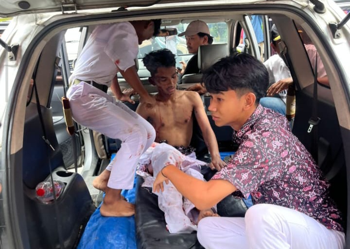 Salah satu korban ledakan. Foto : Ist