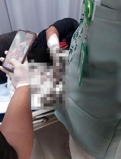 Salah satu pemuda terlihat mengalami luka serius akibat tawuran yang terjadi di Setu.